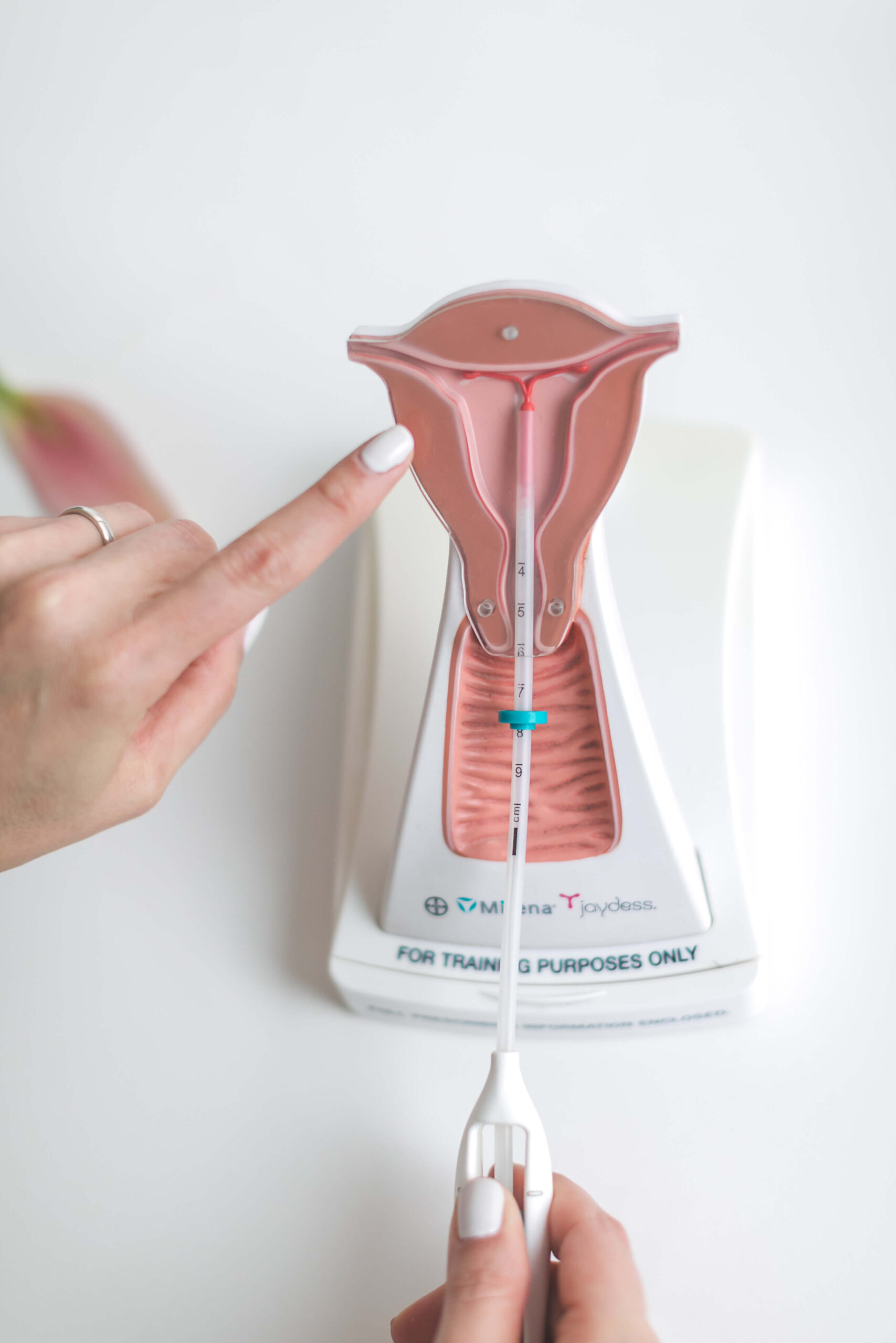 Cuál dispositivo intrauterino (DIU) elegir? – Dra. Cristina Rodriguez G –  Especialista en Salud Femenina